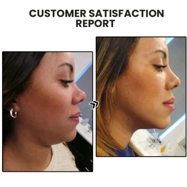 💥Last Day Promotion 80% OFF 🔥Histone Lymphvity MagneTherapy Germanium Earrings