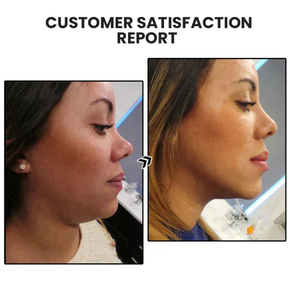 （🔥LAST DAY SALE-80% OFF)Histone Lymphatic MagneTherapy Germanium Earrings